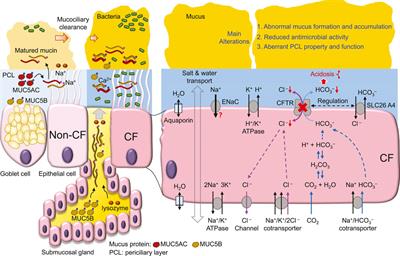 CFTR dysfunction leads to defective bacterial eradication on cystic fibrosis airways